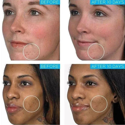 Effaclar Cream Duo+M 40 ml